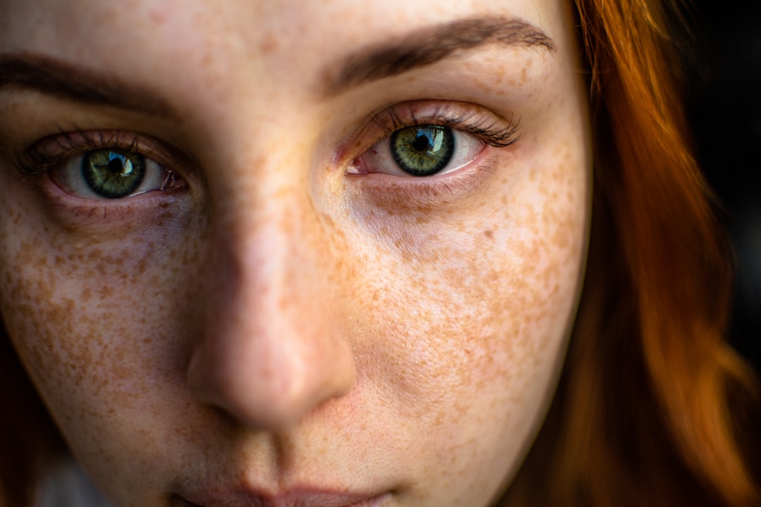 Photo Sunburned skin