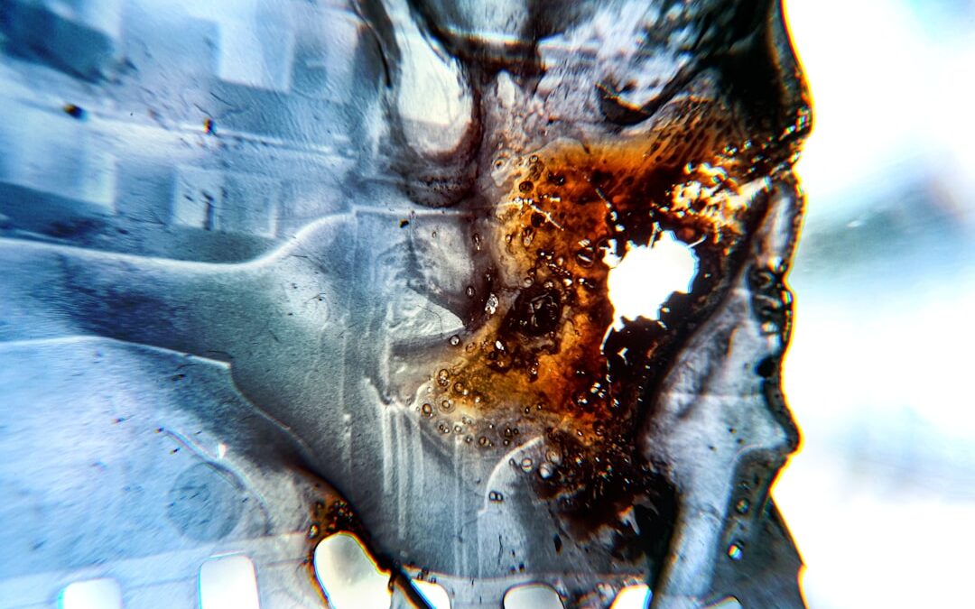Photo Kidney damage