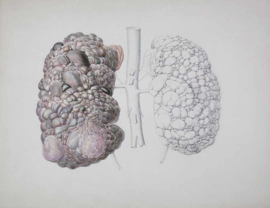 Photo Kidney damage