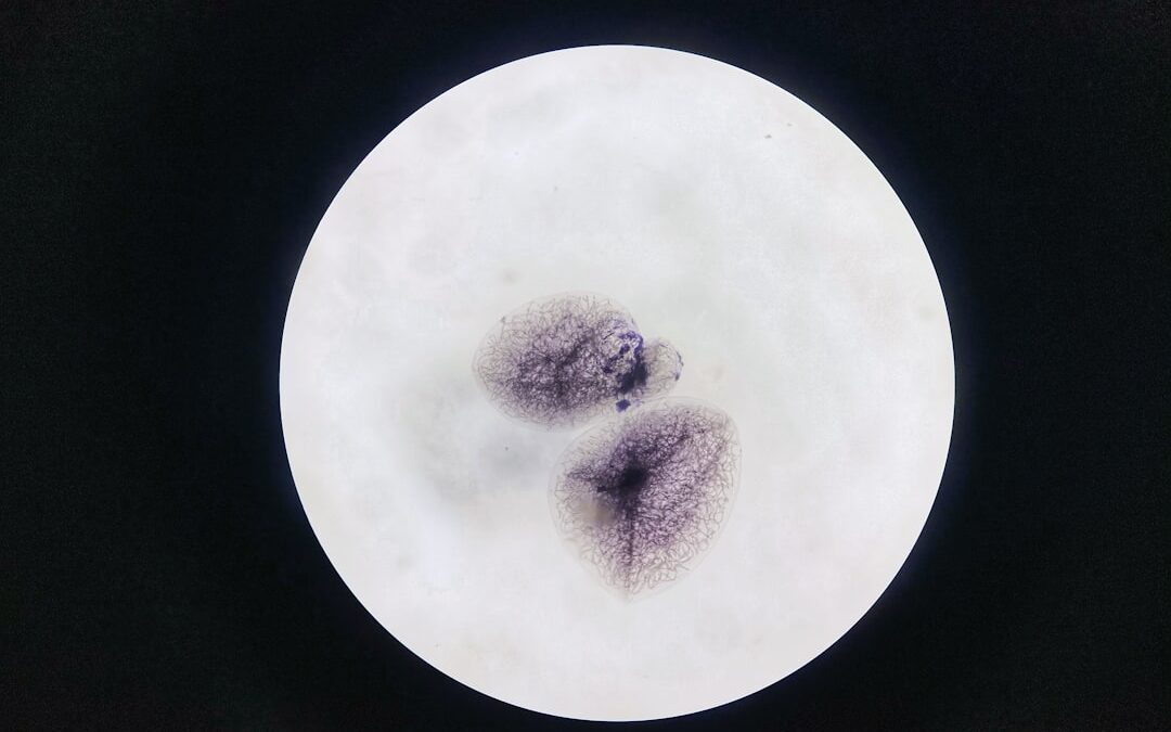 Photo Colonoscopy results