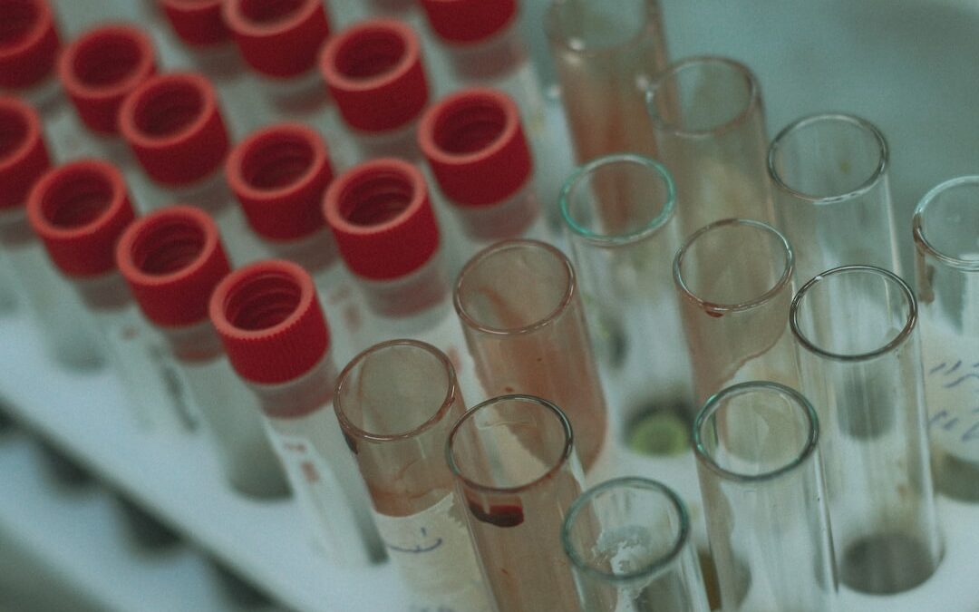 Photo Blood smear