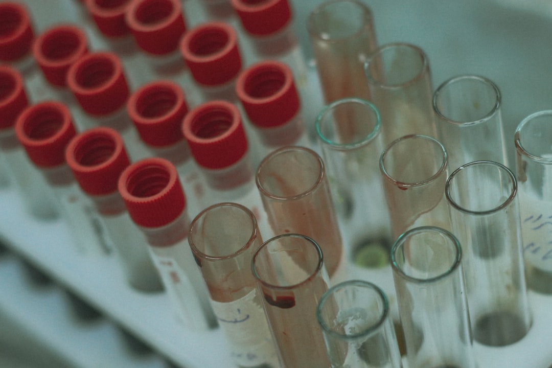 Photo Blood smear