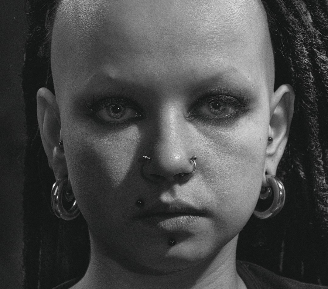Photo Genetic disorder