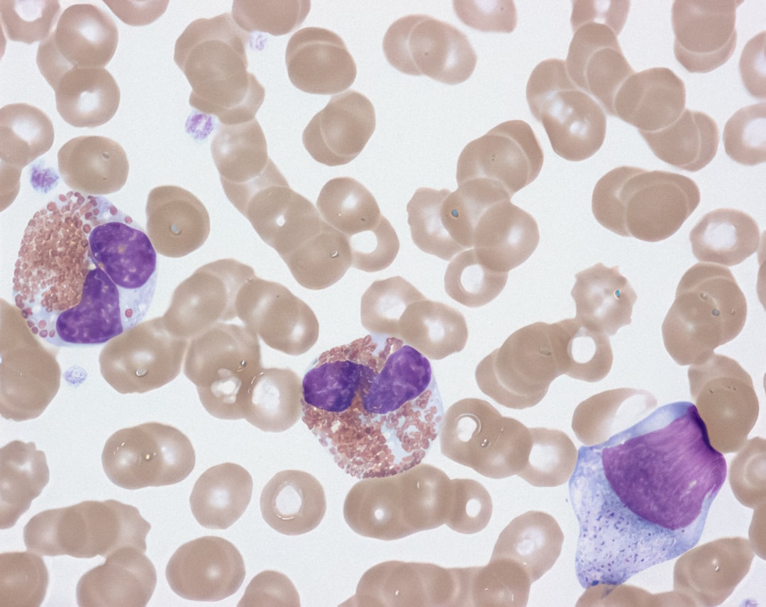 Photo Low white blood cells