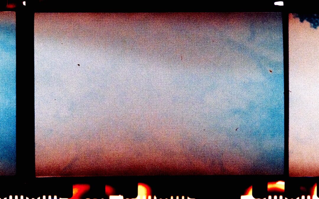 Photo Endoscope image