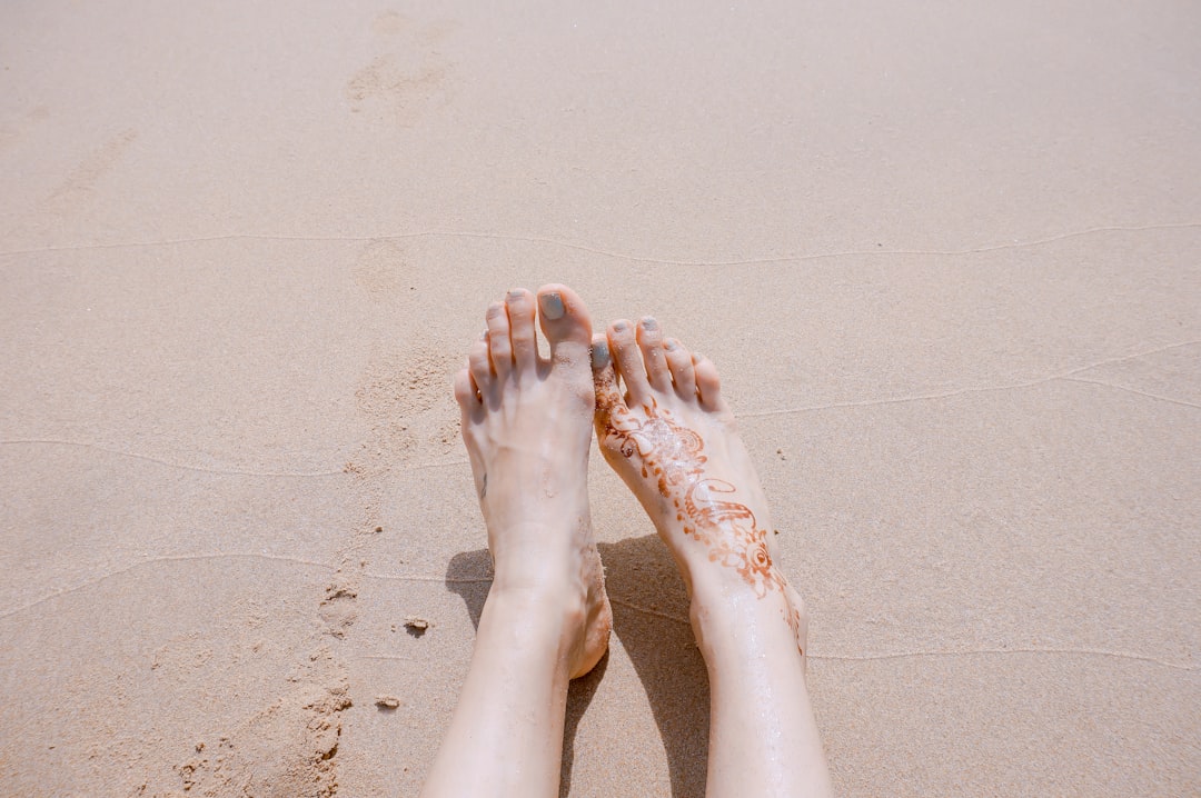 Photo Sunburned skin