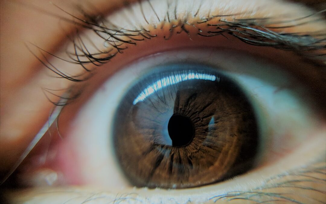 Photo Eye inflammation