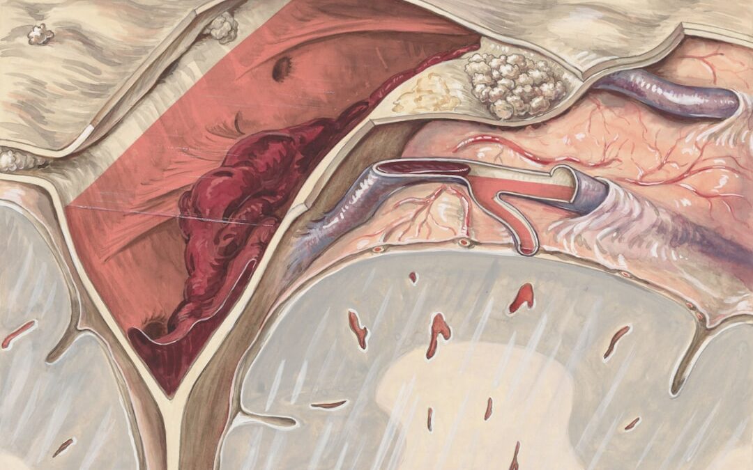 Photo Swollen lymph nodes