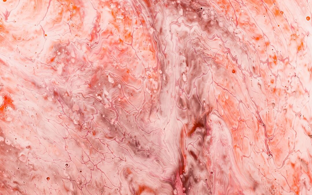 Photo Swollen lymph nodes