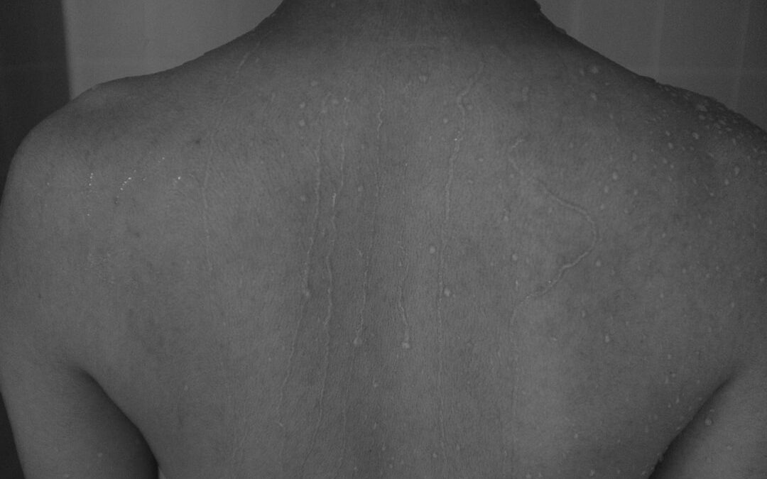Photo Sinus X-ray