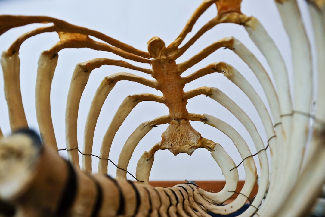 Photo Spinal cord