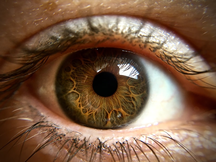 Eye examination