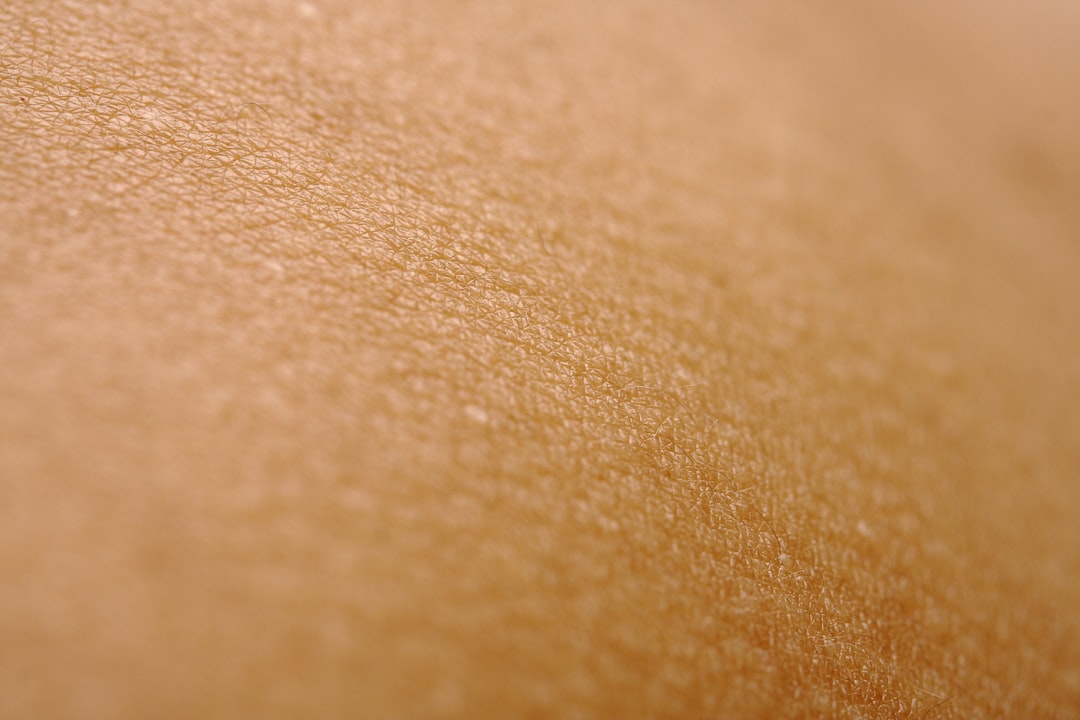 Photo Skin growths