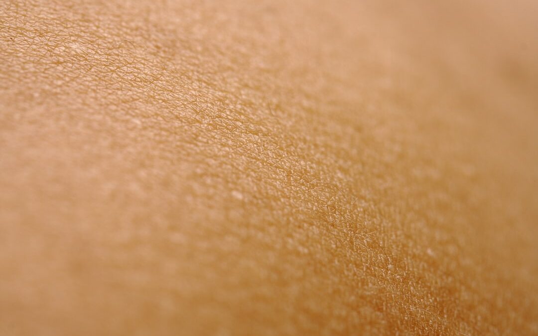 Photo Skin growth