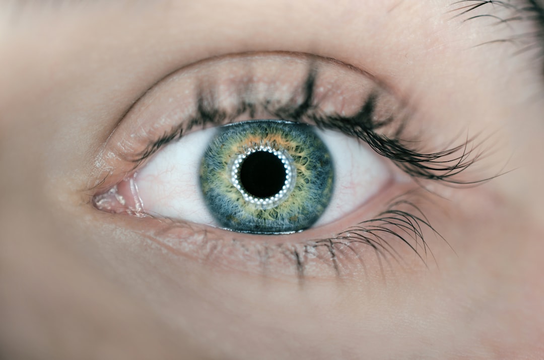 Photo Eye with warts