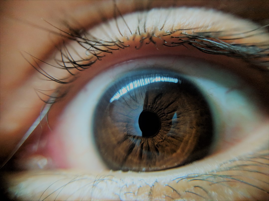 Photo Eye wart