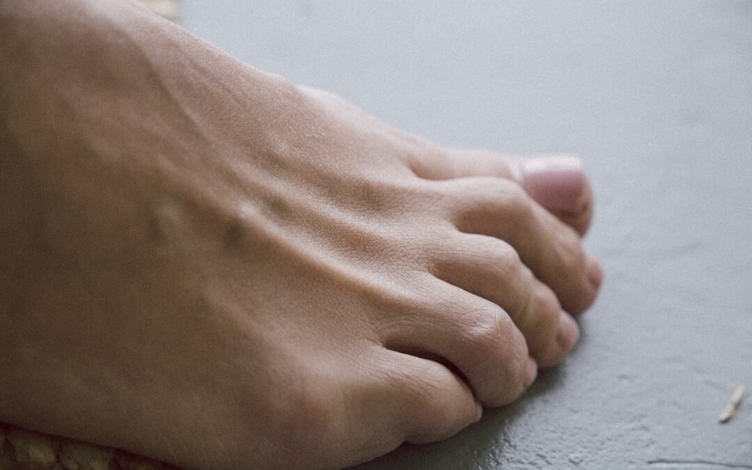 Photo Foot treatment