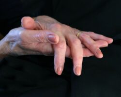 Photo Dermatologists hand