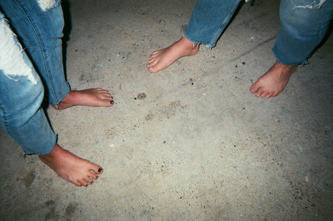 Photo Foot with wart