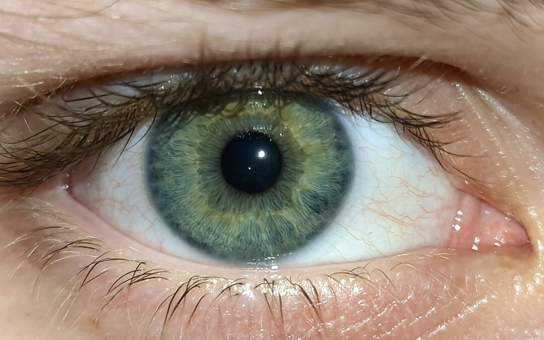 Photo Eye misalignment