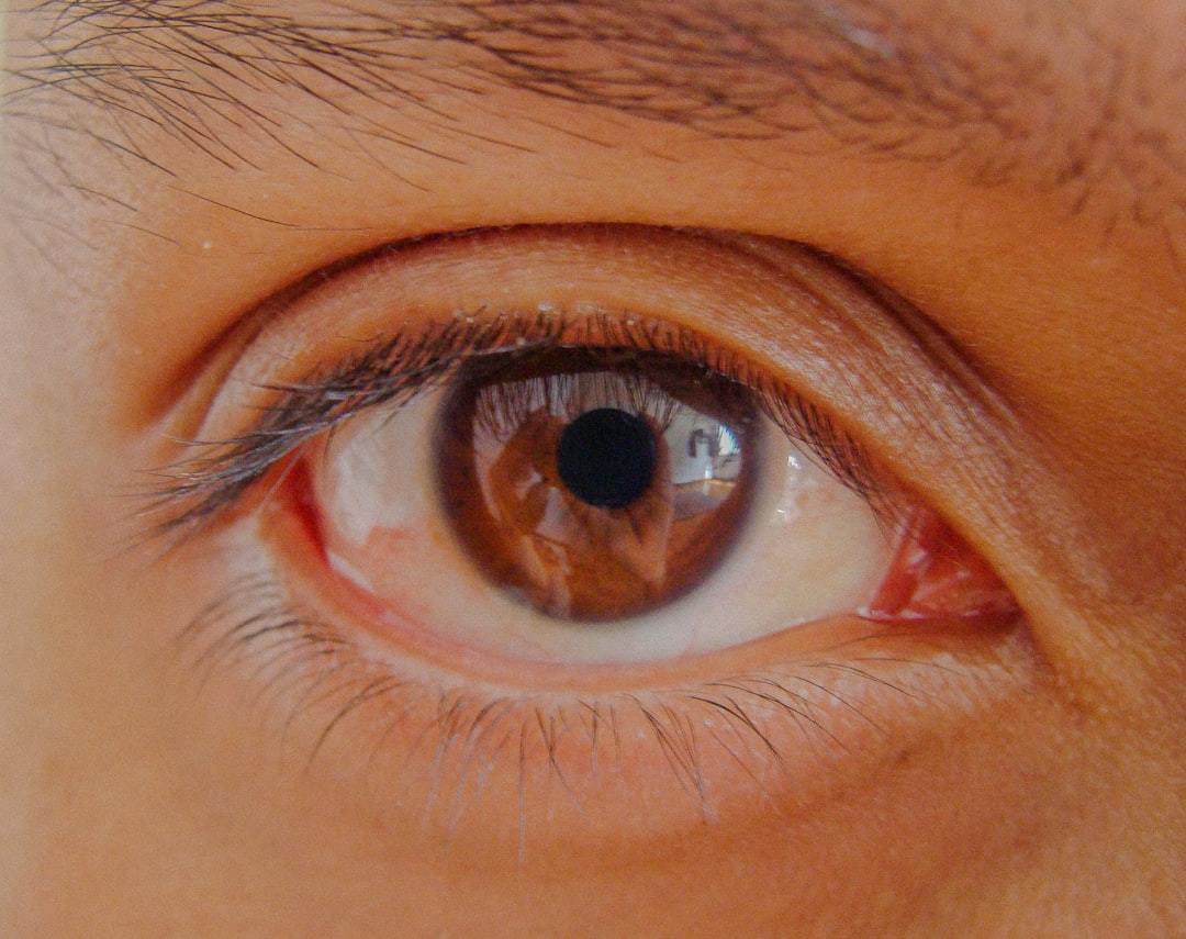 Photo Eye examination