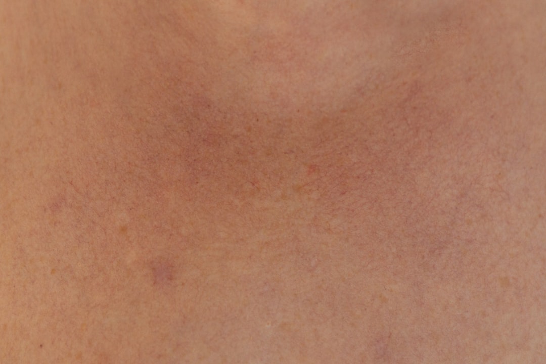 Photo Skin condition