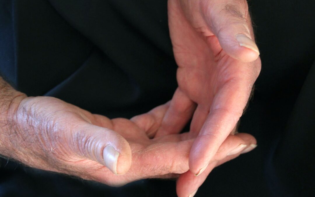 Photo Callus on hand