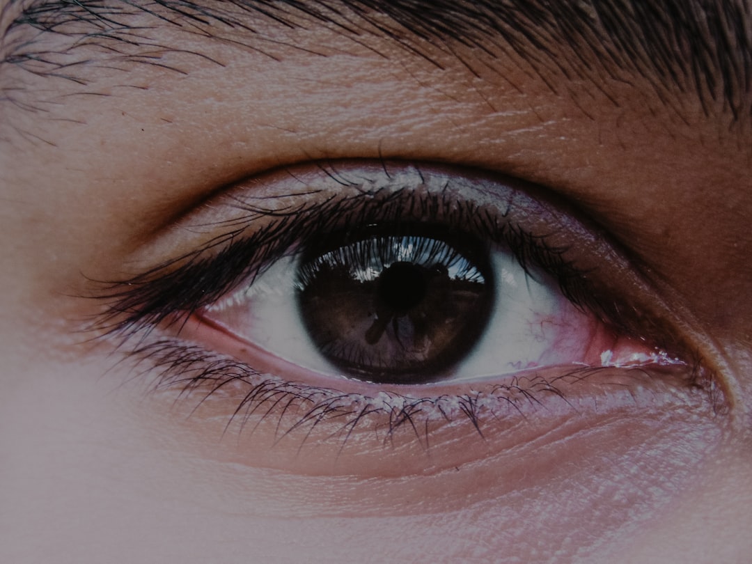 Photo Eye injury: First aid