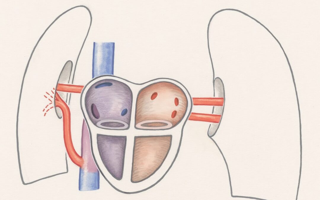 Photo Medical diagram