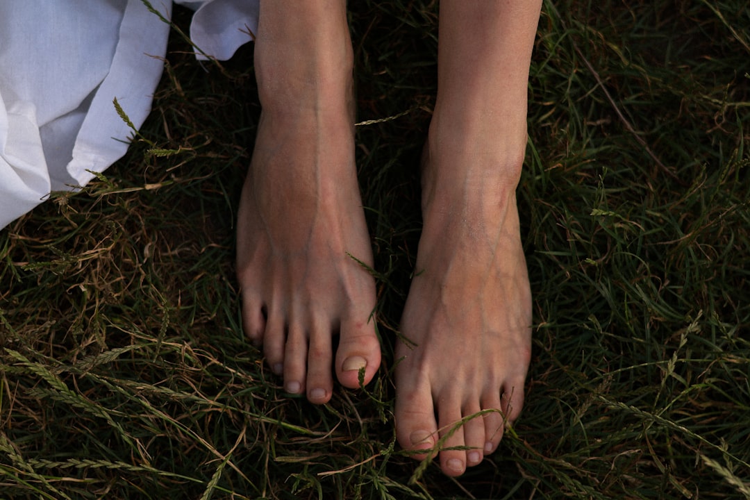 Photo Foot with wart