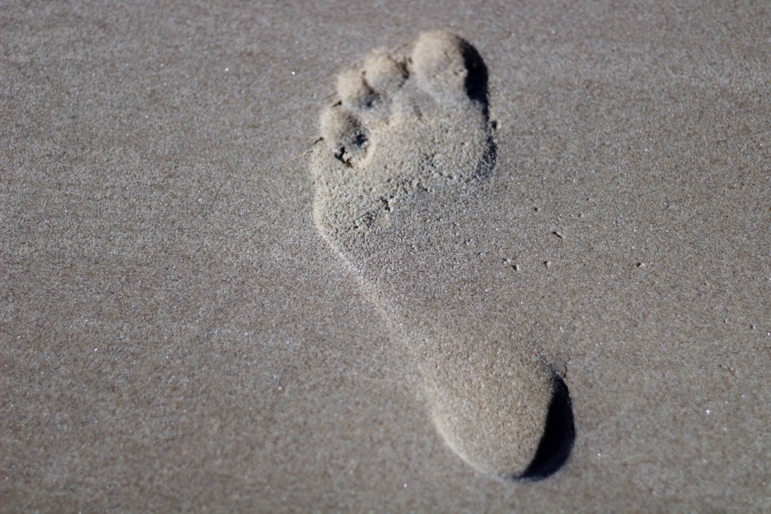 Photo Foot with wart