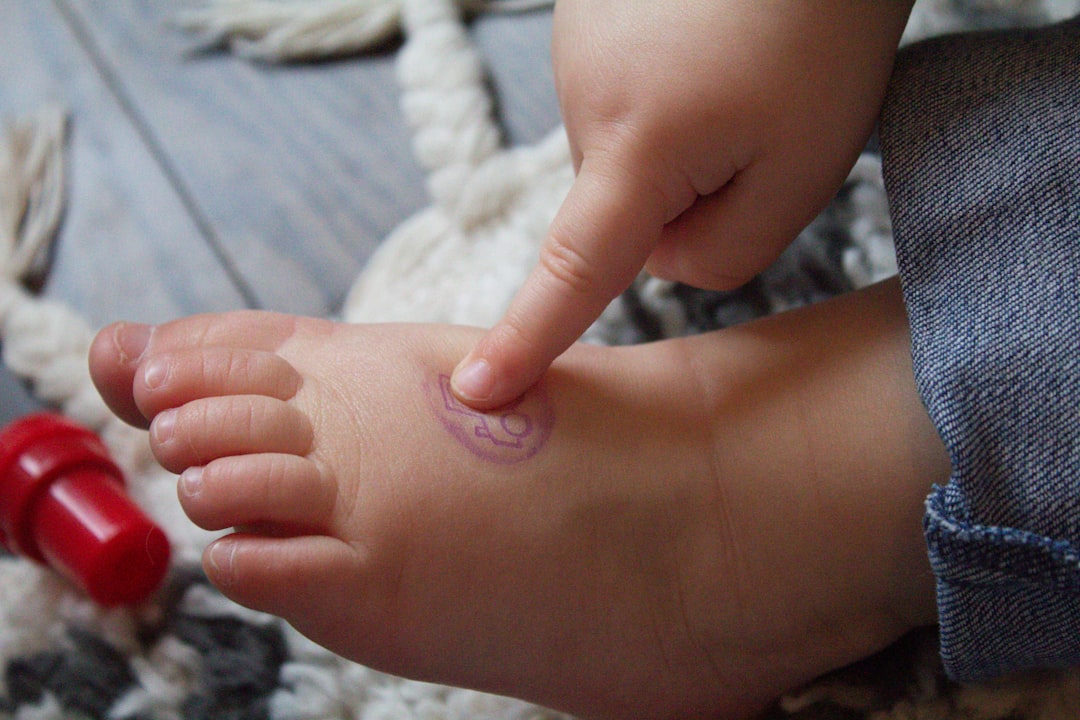 Photo Foot with wart