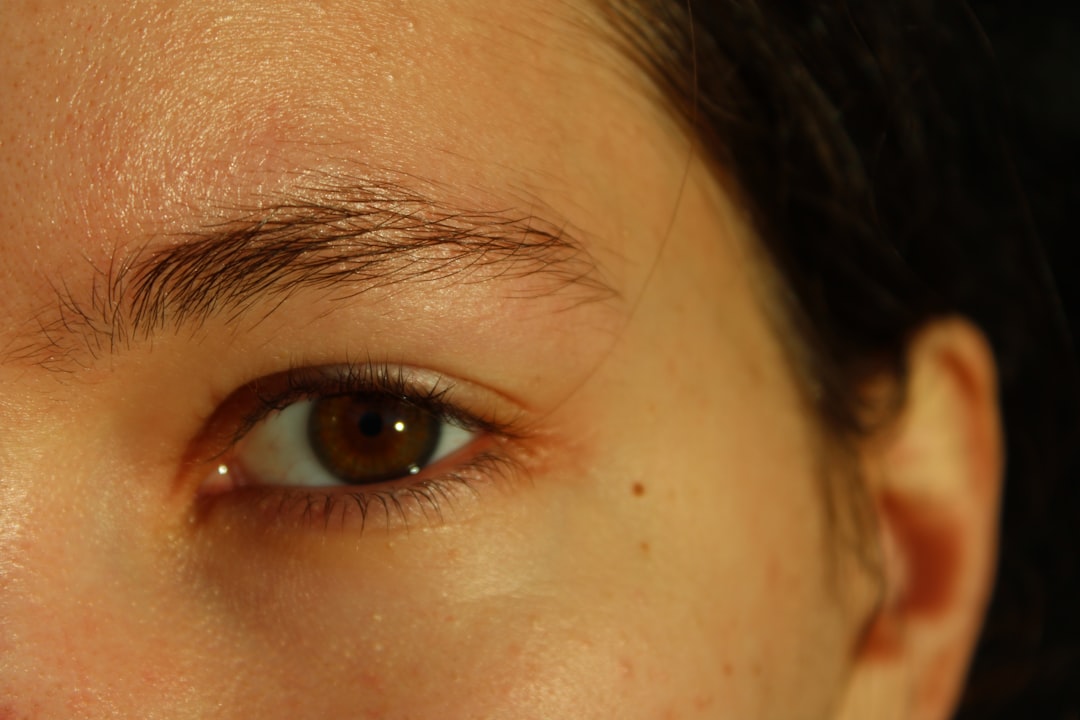 Photo Skin growth