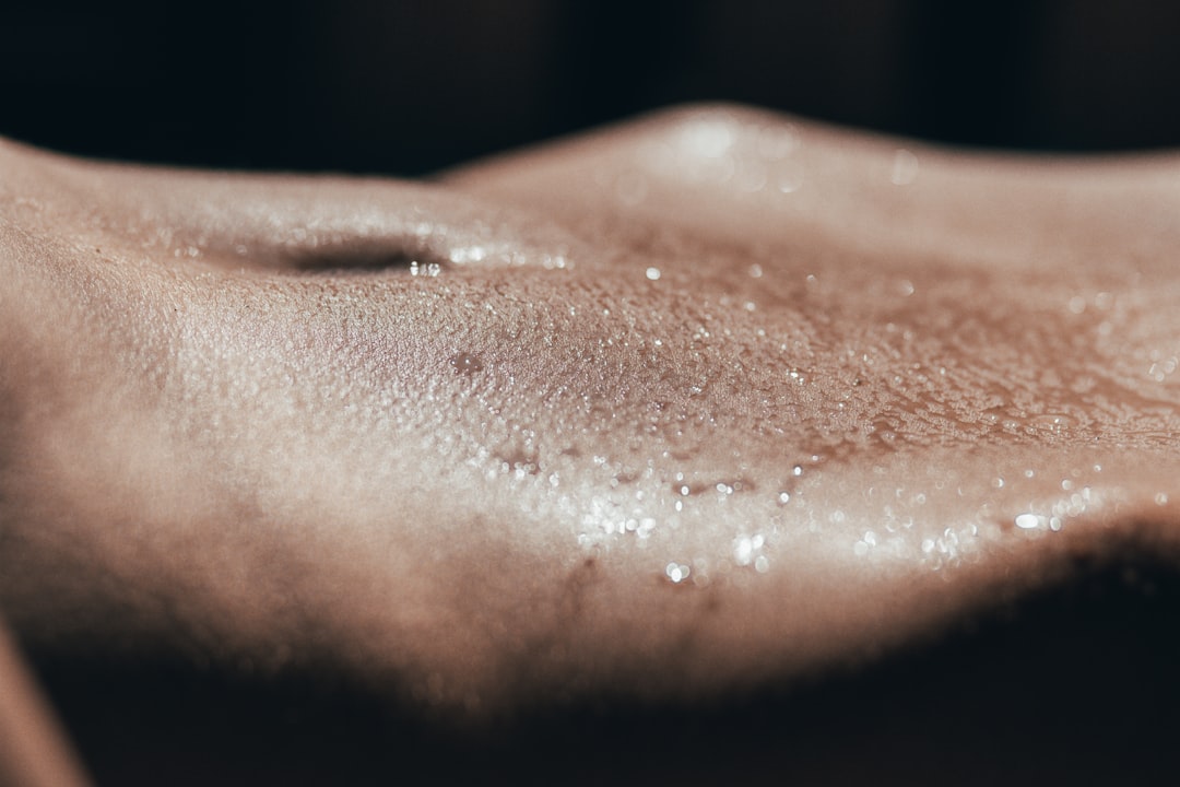 Photo Dry skin