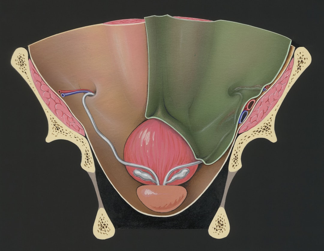 Photo Medical diagram
