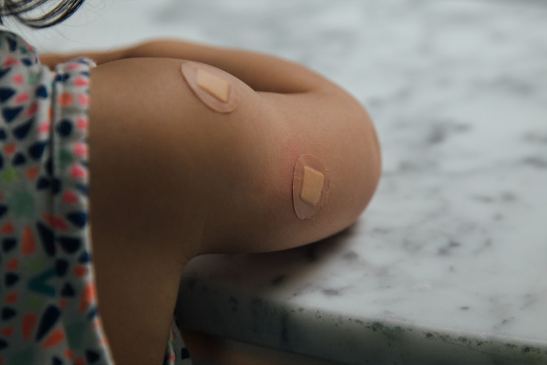 Photo Skin tags