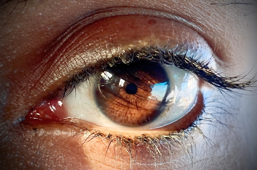 Photo Eye examination