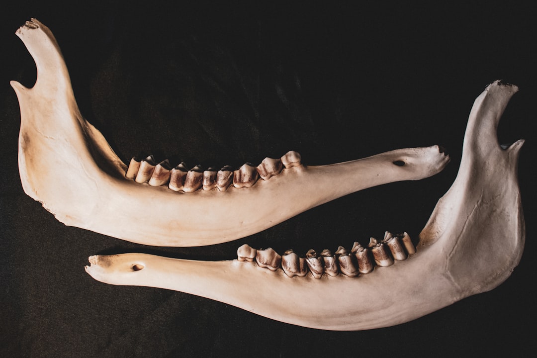 Photo Foot with callus