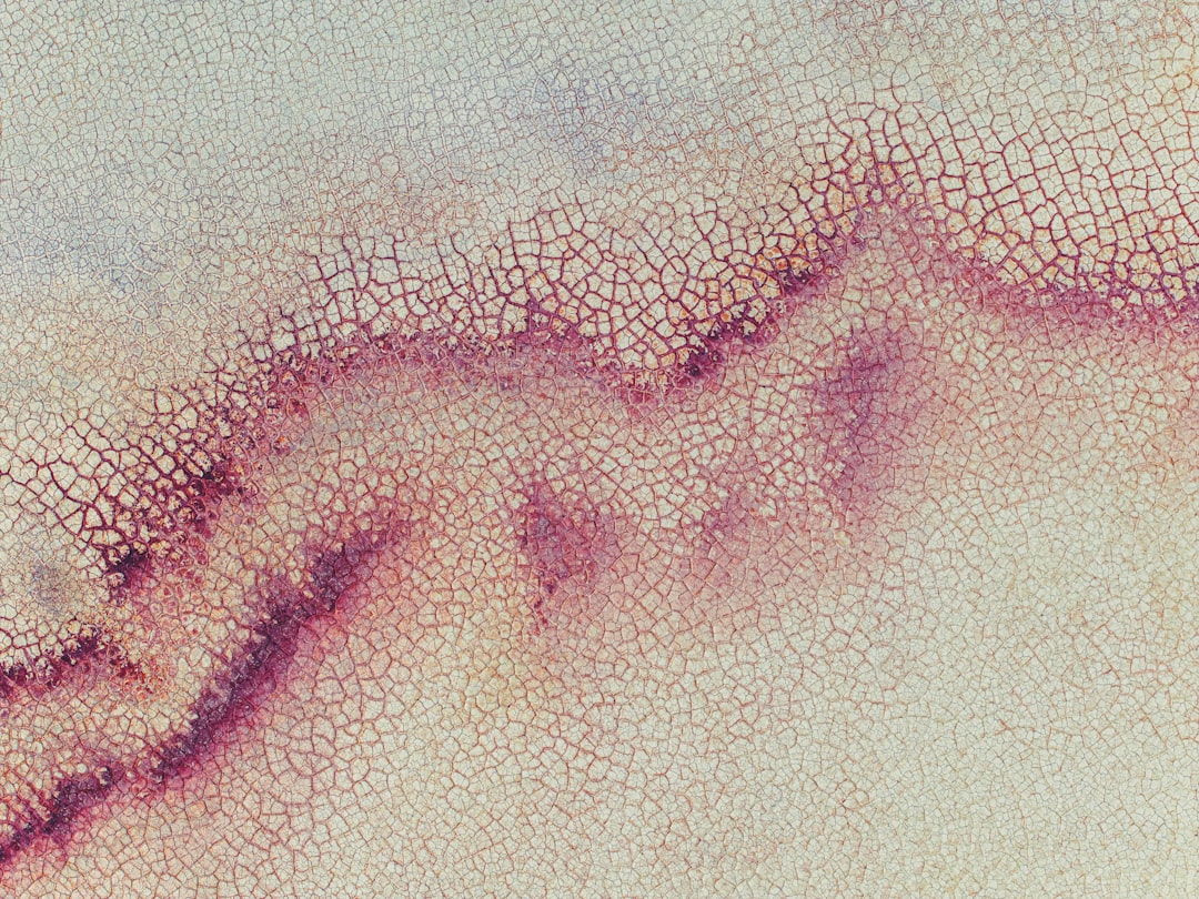 Photo Skin-colored bump