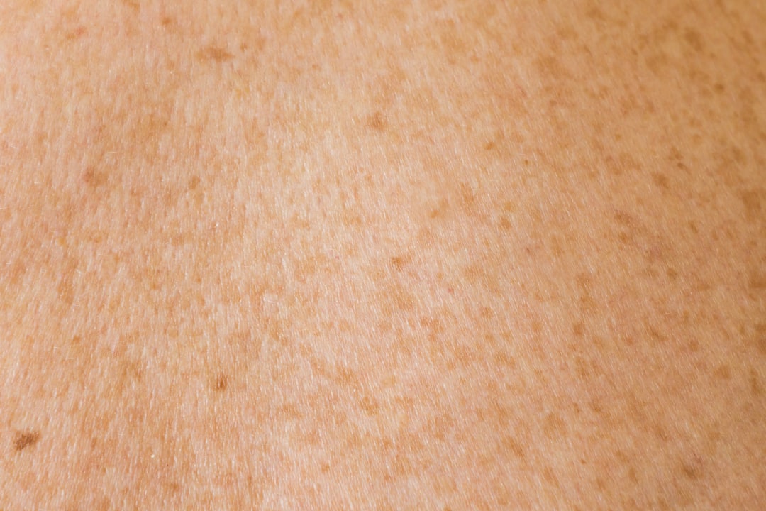 Photo Skin growth