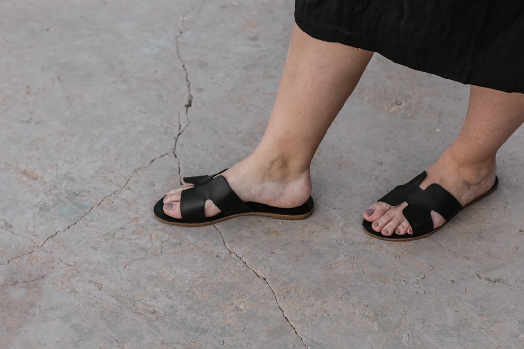 Photo Callus on foot