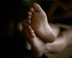 Photo Foot with wart