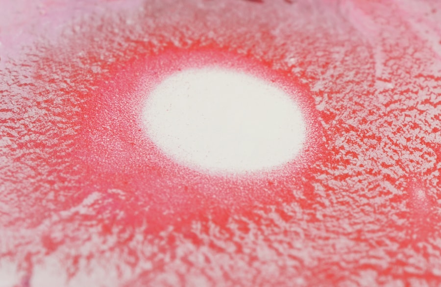 colorectal polyp symptoms