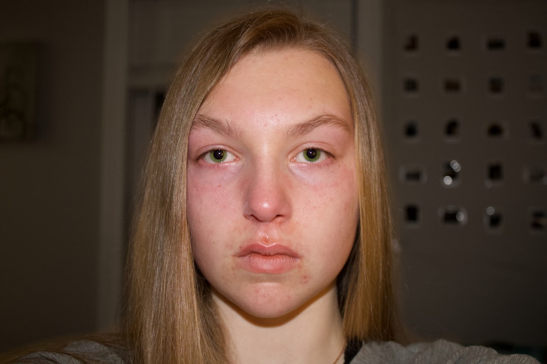 Photo végbél sérv symptoms