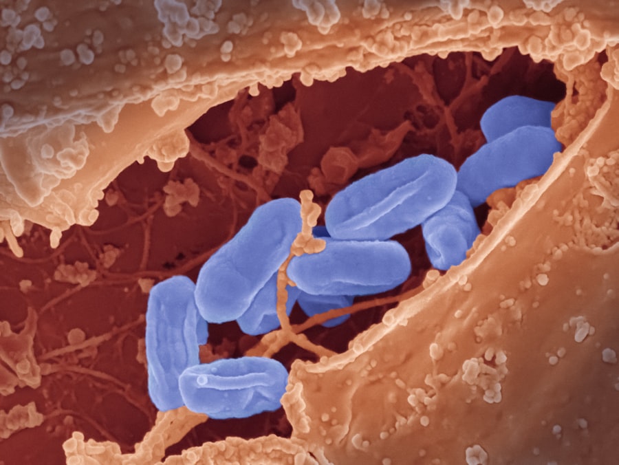 Photo Hasmenés veszélyei
Diarrhea risks