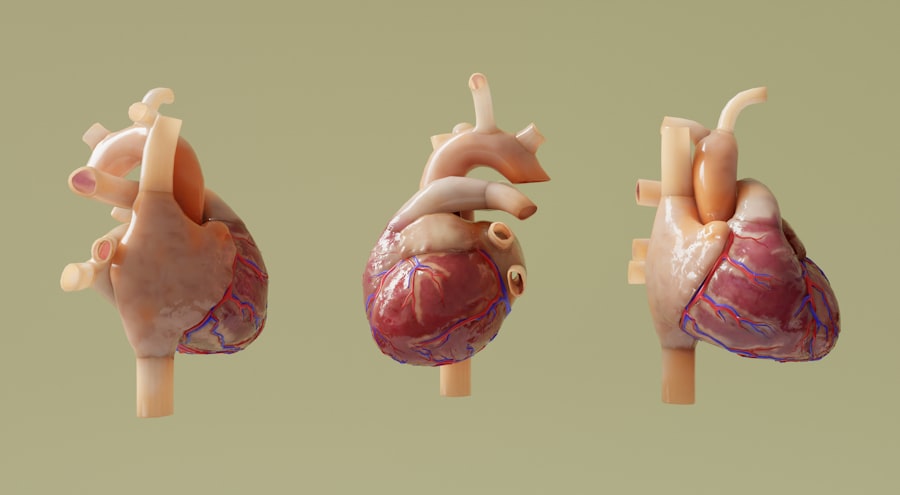 Photo Heart diseases