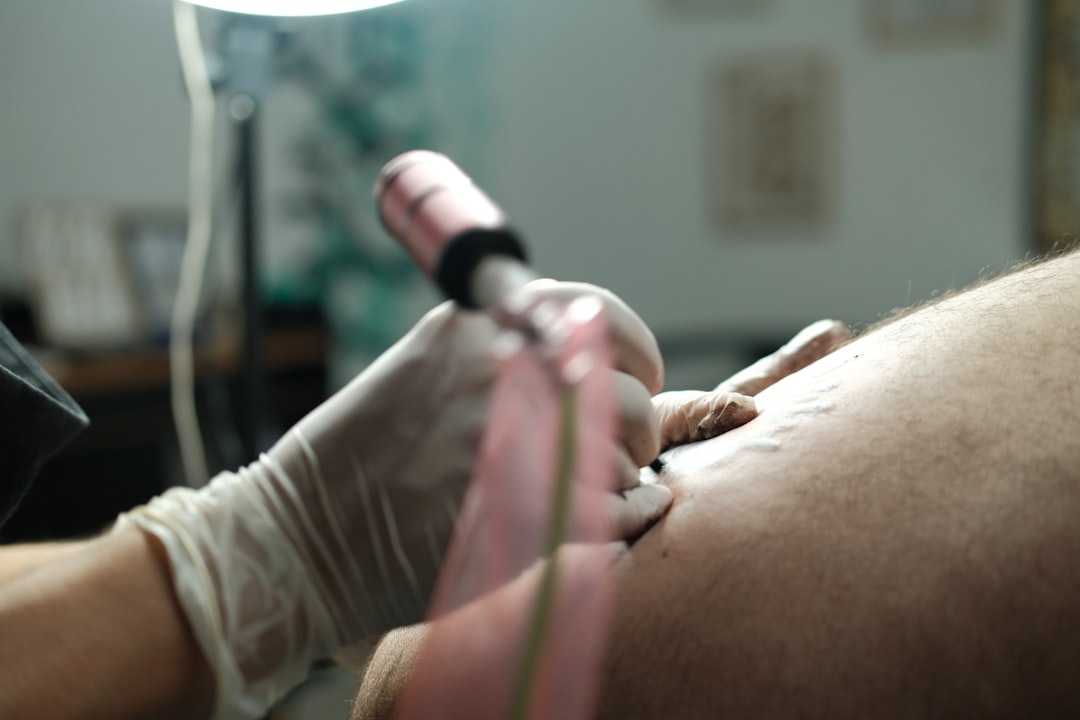 Photo anal fissure treatment