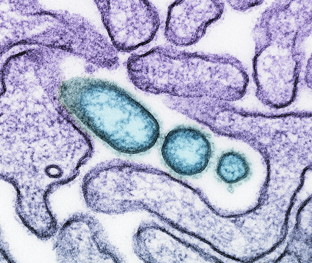 Photo herpes