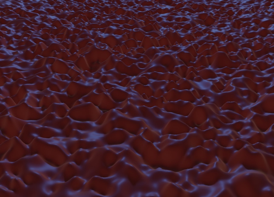 Photo hemorrhoids