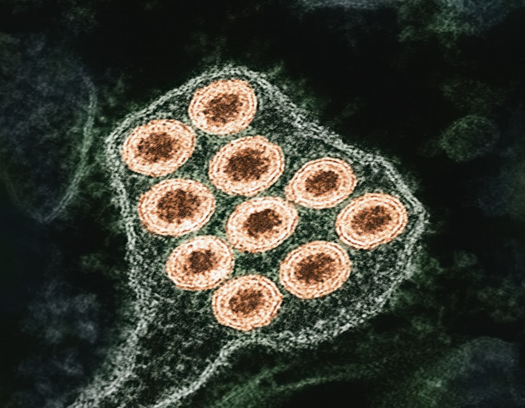 Photo herpes